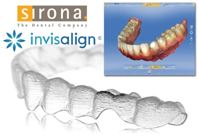 Invisalign 3D imaging