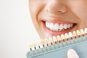 comparing teeth whitening shades